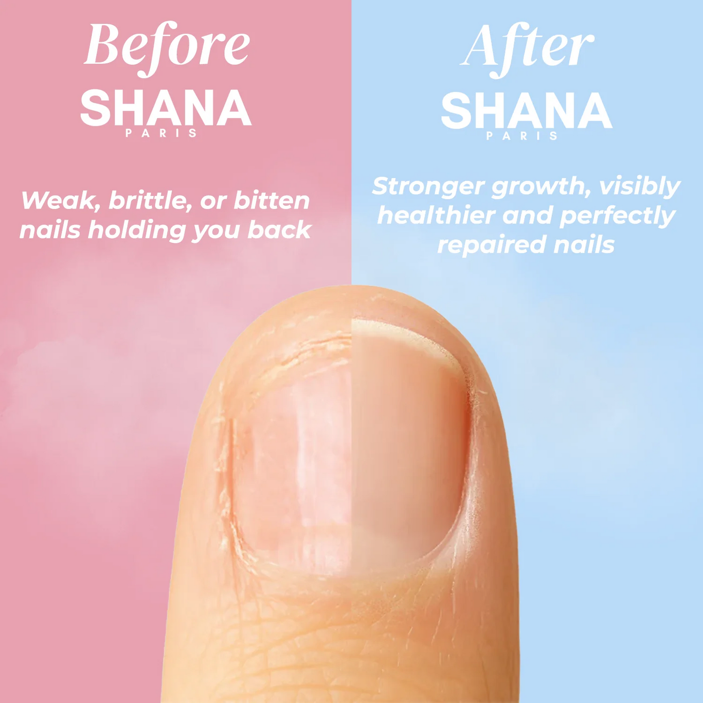 قلم زيت لنمو الأظافر وتقويتها