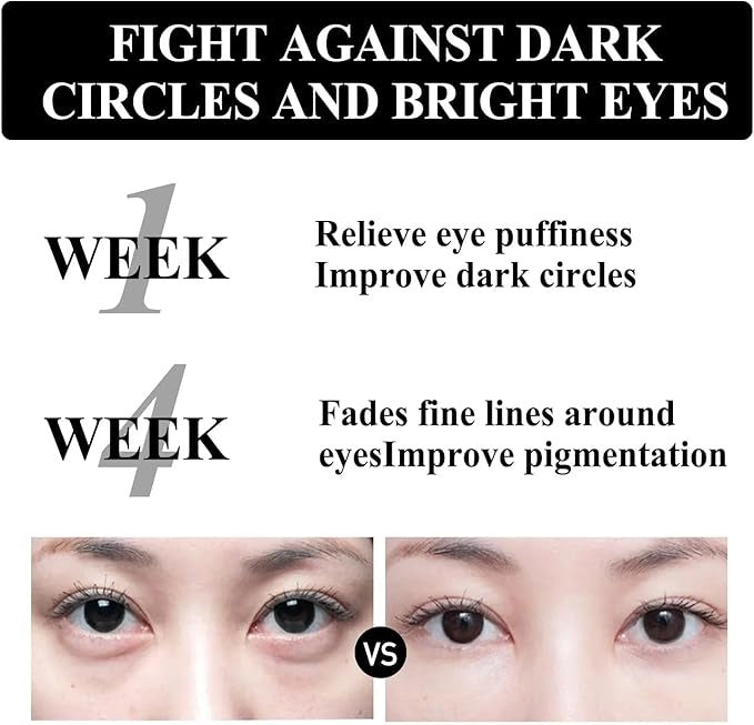 كريم سم الأفعى لعلاج الهالات وتجاعيد تحت العين – SADOER Snake Venom Eye Cream