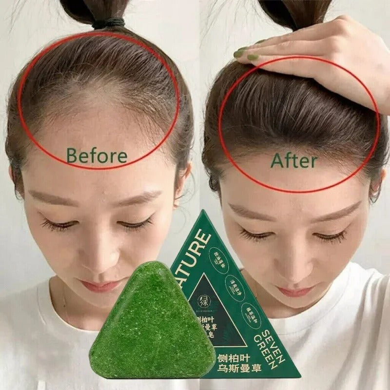 شامبو صلب طبيعي بخلاصة الأعشاب الخضراء