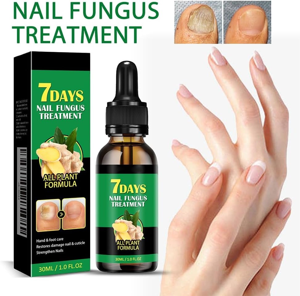 علاج فطريات الأظافر