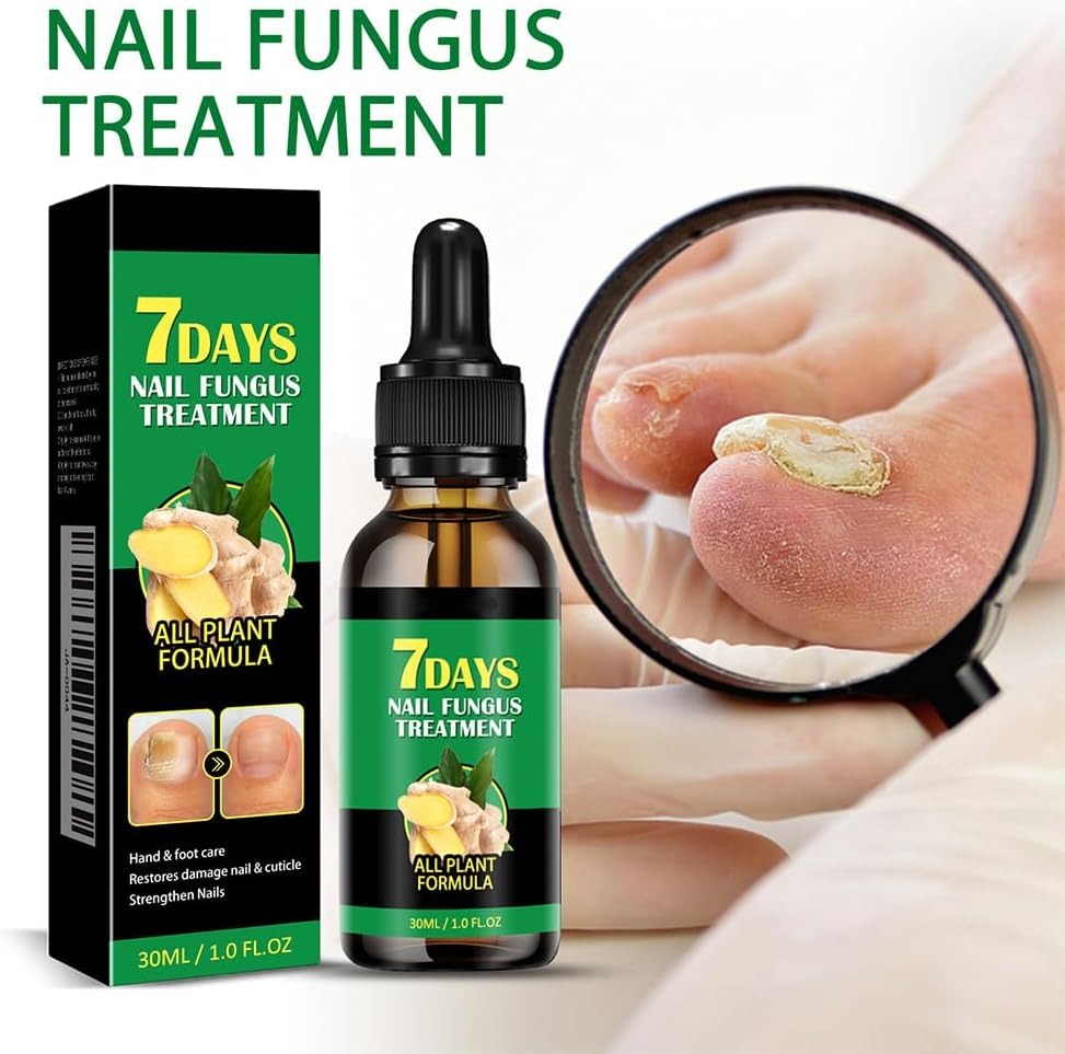 علاج فطريات الأظافر