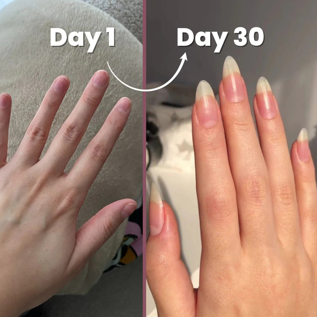 قلم زيت لنمو الأظافر وتقويتها