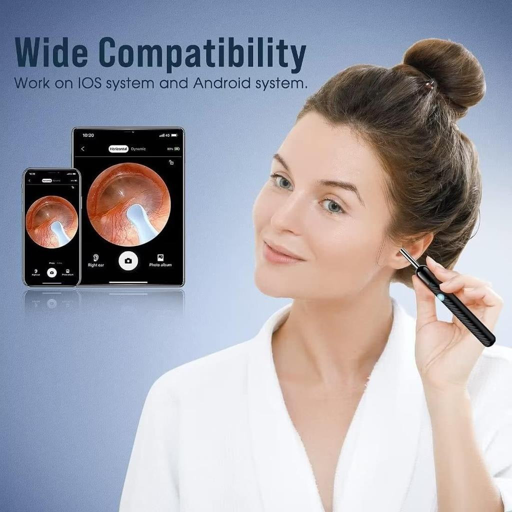عصا تنظيف الأذن الذكية – كاميرا عالية الدقة