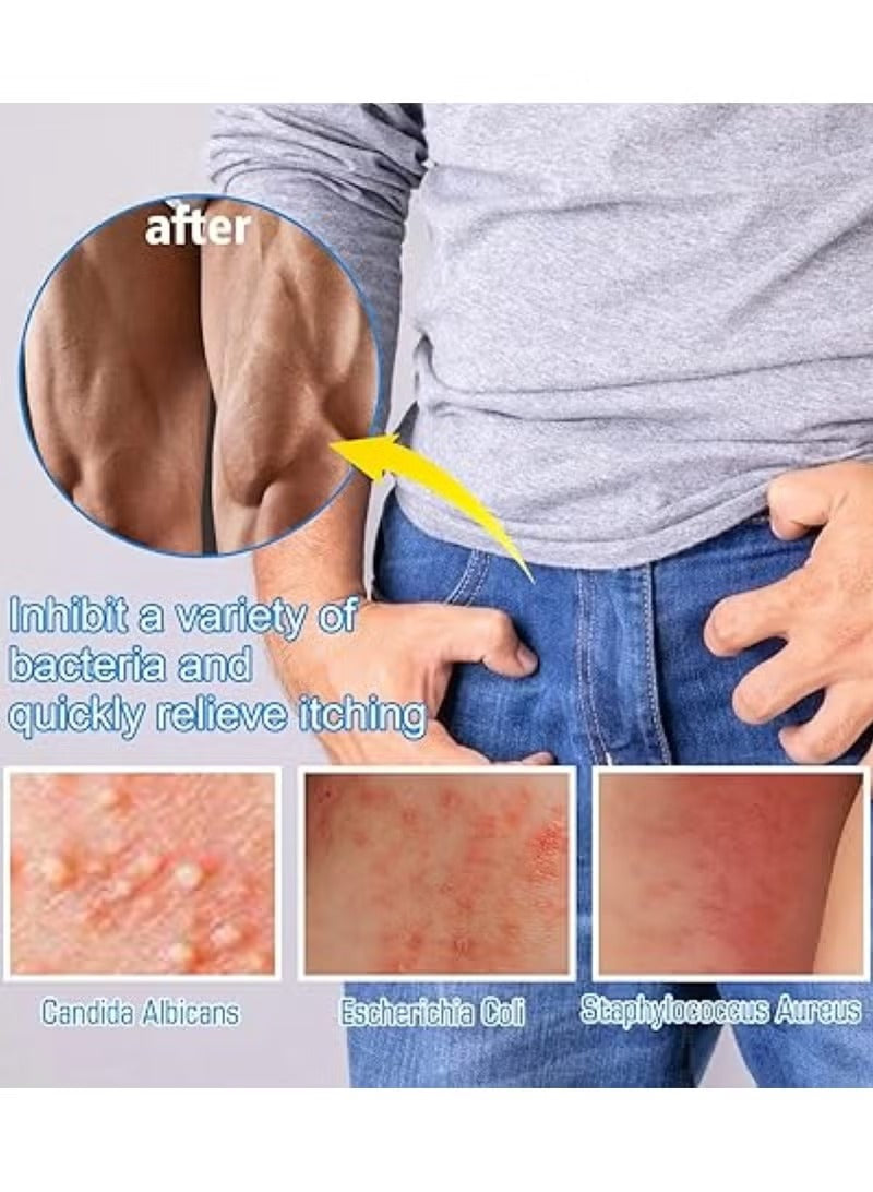 كريم مضاد للبكتيريا للمناطق الحساسة – Private Antibacterial Cream – 20g