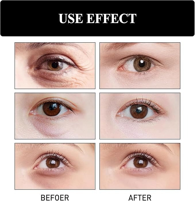 كريم سم الأفعى لعلاج الهالات وتجاعيد تحت العين – SADOER Snake Venom Eye Cream