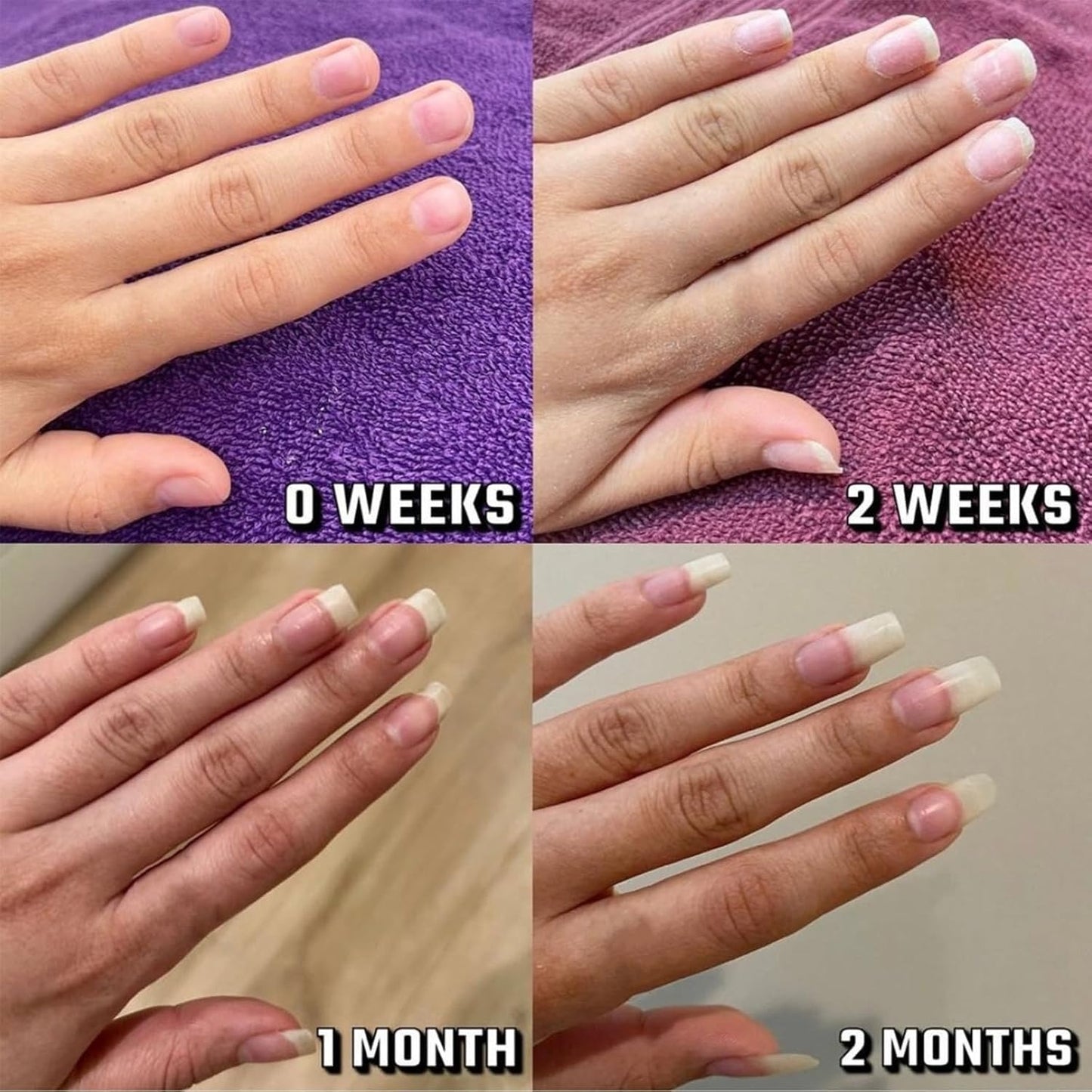 قلم زيت لنمو الأظافر وتقويتها