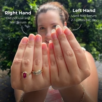 قلم زيت لنمو الأظافر وتقويتها